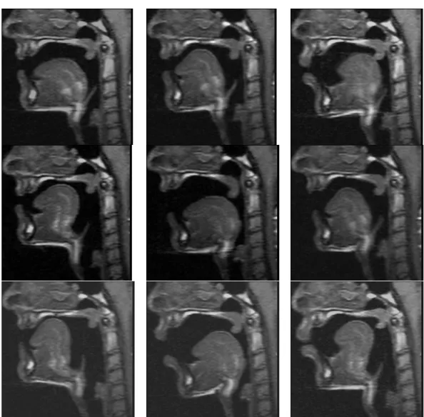 Figure 2: Training images used to build the tongue shape model, showing the different shapes and positions of  the lips and the tongue during sustained articulation of the oral vowels