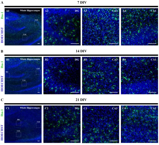 Figure  5|  Microglia  activation  in  organotypic  slices  at  7,  14  and  21  days  in  vitro (DIV)