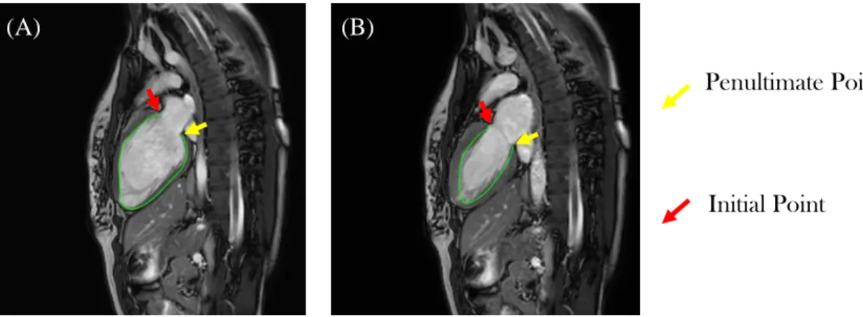 Figure 3.2 Two contours drawn using the Matlab interface. The number of points used to draw the contour in image  (A) is greater than the one used in image (B)