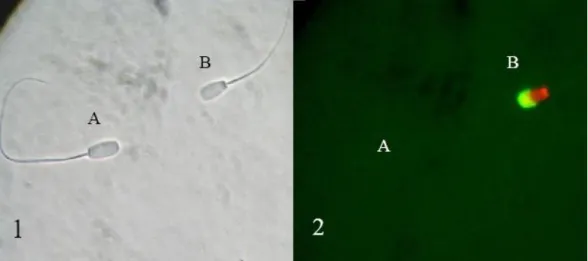 Figura 4- Fotografia em microscopia de contraste de fase (1) e epifluorescência (2) do mesmo  campo de leitura