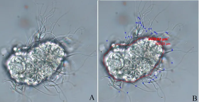 Figura 6-  Fotografia de contraste de fase em aumento de 40x do complexo agregado células  da  tuba  uterina-espermatozoides  após  30  minutos  de  co-incubação  com  espermatozoides  recuperados do epidídimo (A) e após a contagem dos espermatozoides (mar
