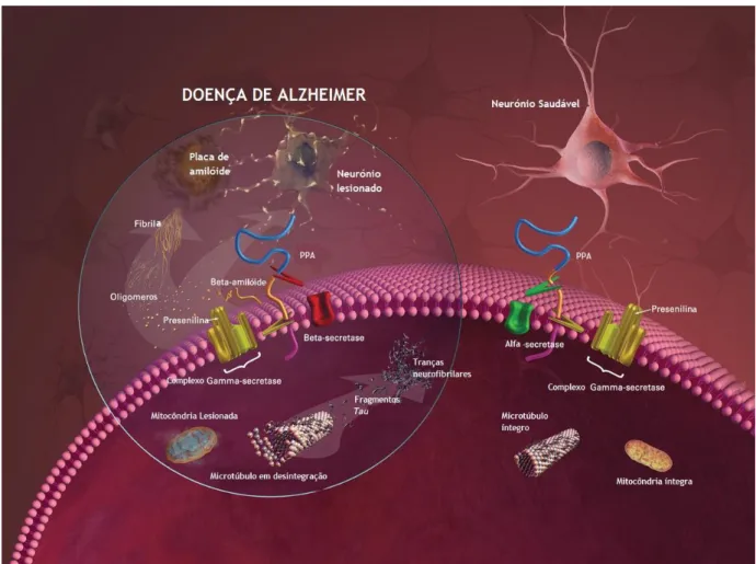 Figura 3 Imagem resumo da fisiopatologia da DA. Formação de placas amilóides  e tranças neurofibrilares