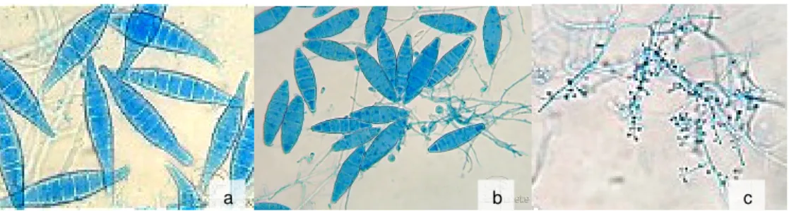 Figura 3 – Imagens microscópicas de macroconídeas de  M. canis e de  M. gypseum, e de  microconídeas de T