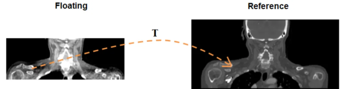 Figure 2.10: Schematization of a deformable registration performed in the backward direction which maps a CBCT image (floating) to a CT image