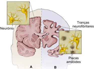 Figura 3.1 – Cérebro dividido em duas secções, com representações macroscópicas e microscópicas