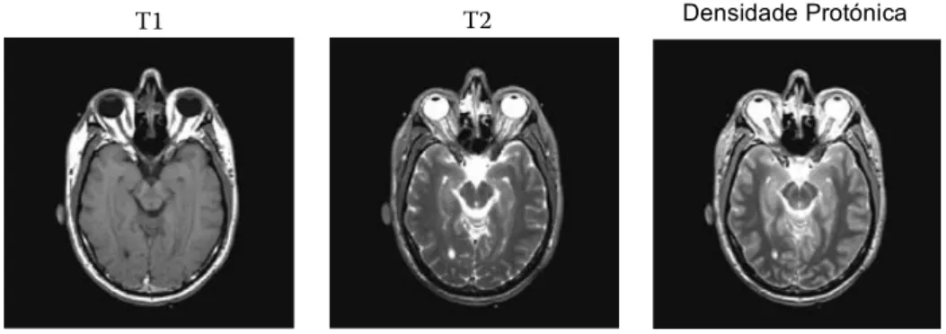 Figura 4.1 - Diferentes mecanismos de contraste foram utilizados para criar imagens de RM ponderadas em 