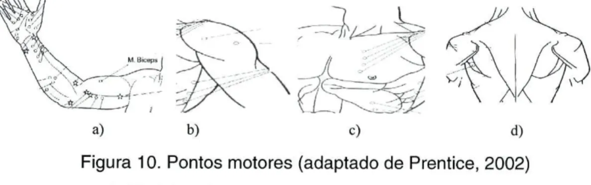 Figura 10. Pontos motores (adaptado de Prentice, 2002)  a) Bicípite; b) Deltóide; c) Peitoral; d) Redondo maior