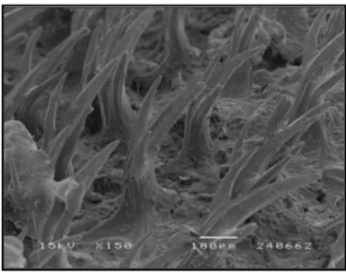 Figura 11. Imagem em SEM (vista lateral) de dentículos dérmicos de um exemplar de  Deania profundorum  por mim  amostrado e identificado