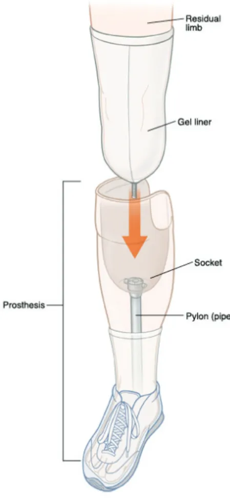 Fig. 3 - Esquema de componentes de  uma prótese para amputações acima  do joelho.