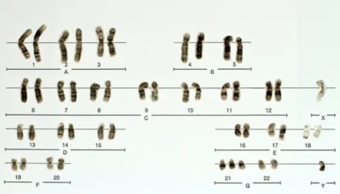 Figura 5: Jerôme Lejeune (Bassani, 2012, p.7)