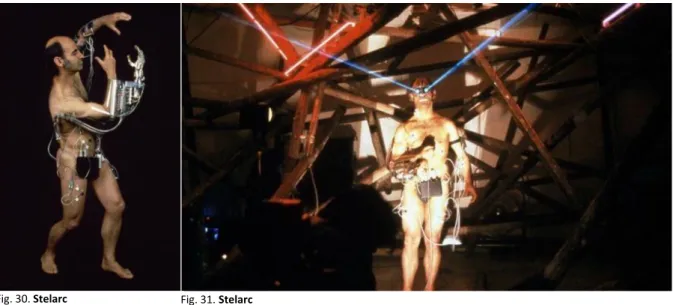 Fig. 30. Stelarc      Third Hand (1980)  Fonte: http://stelarc.org/ 