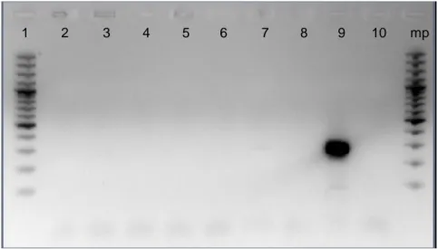 Figura 7 – Ensaio de especificidade do par de primers para  Campylobacter sp, num  conjunto  de  19  amostras,  em  que:  1-  Leuconostoc  sp;  2-  Lactococcus  lactis;  3-  Haemophylus  ducreiy;  4-  Serratia  sp;  5-  Morganella  sp;  6-  Bacillus  subti