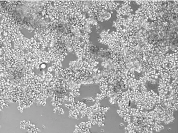 Figura 2.10 - Fotografia tirada, com ampliação 100x, a uma subcultura de células MDA-MB-231 depois de 24h de contacto  com meio de cultura suplementado com 10% de DMSO