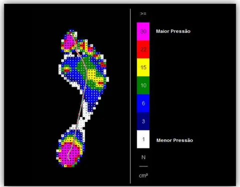 Figura 2.2 – Imagem representativa da pressão plantar e o respetivo mapa de cores   (adaptado de(Seitz 2008))