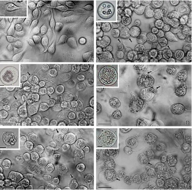 Fig.  2.  Structural  analysis  of  wild-type  and  mutant  baculovirus-infected  Tn-5B  cells