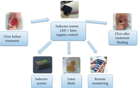 Figure 1: Flowchart for the application of the randomized clinical trial of research participants with wounds: natural latex and light-emitting circuit of LEDs.