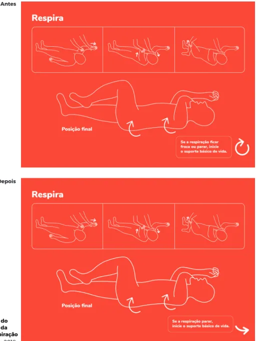FIGURA 101: A-B Placa: modificação do ícone de viragem e da frase relativa à respiração                            Fonte: Investigadora, 2018   
