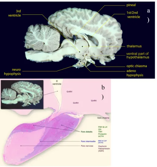 Figure 1.1: Location of the Horse Pituitary Gland. In a) we can see an image of a brain of a horse and the location of the pituitary gland