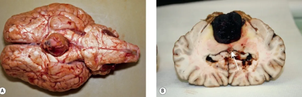 Figure 1.2: Horse Pituitary adenoma. (A) - Pituitary hyperplasia was confirmed histologically in this gland from a 25-year-old Welsh pony mare presented with all the signs of pituitary pars intermedia dysfunction (PPID/equine Cushing’s disease)