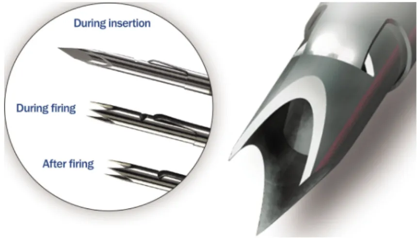 Figure 3.2: Representation of the biopsy device called BioPince. On the left, we can see three imagens of the device: during the insertion on the tissue and before firing - the first one, during the firing to harvest a sample - second one, and the last one
