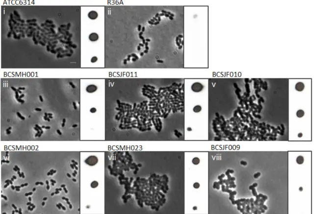 Figure  5:  Confirmation  of  production  of  capsular  polysaccharide  due  to  expression  of  fluorescent  derivatives  of  Wzd  and  Wze  by  agglutination  and  Dot-blot