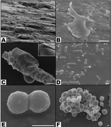 Figure 10.  Bar graphs representing the proportion of scanning electron microscopy (SEM) fields in the  different experimental groups with no bacteria, with planktonic bacteria, with both planktonic bacteria and  biofilm, and only with biofilm