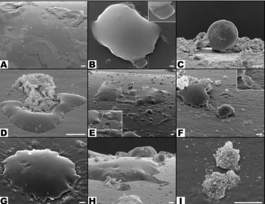 Figure 11.  Typical scanning electron microscopy images of the surface of catheters showing multiple features  of leucocyte morphology and interaction with the surrounding environment