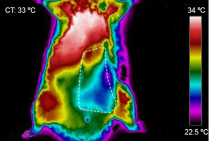 Figure 3 shows the typical thermographic appearance of the flap one hour after surgery, illustrating the lower  temperature of the flap compared to the contralateral side