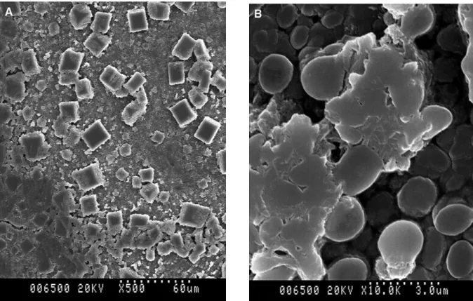 Figura  1:  Microfotografias  ao  microscópio  eletrónico  de  varrimento  da  superfície  de  cones  de  GP  após  5  minutos  de  esterilização  com  hipoclorito  de  sódio  5,25%