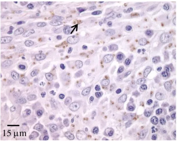Figura 8. IHQ de uma biópsia de nódulo cutâneo de um gato, evidenciando Leishmania spp
