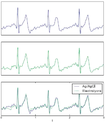 Figure 6 - ECG recorded at hand palms and fingers (Adapted from Silva et al., 2013).