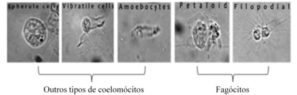 Figura  5  -  Coelomócitos  encontrados  do  fluido  celómico  da  Marthasterias  glacialis