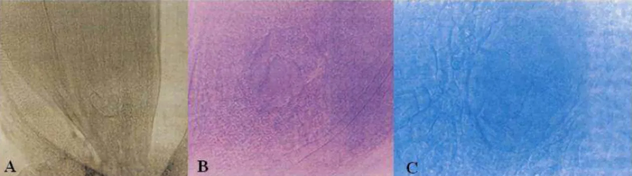 Figura  3.  Sacos  embrionários  apospóricos  em Manihot  esculenta.  A.  Três  sacos  apospóricos  no  tecido  nucelar