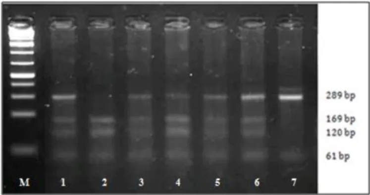 Figura  8  -  Perfil  electroforético  dos  fragmentos  do  gene  MPO  em  gel  de  agarose