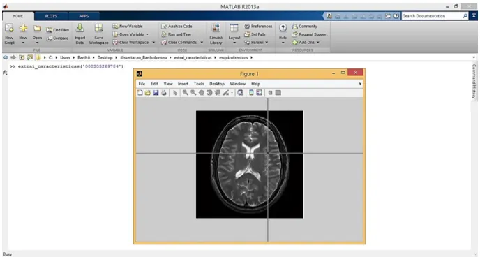 Figura 3.2: Extra¸c˜ ao de caracter´ısticas de imagens de RM.