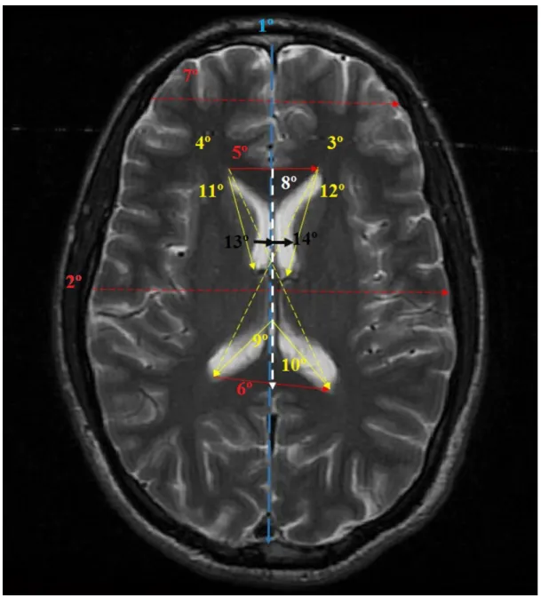 Figura 3.3: Ilustra¸c˜ ao dos 14 comprimentos referentes as estruturas cerebrais no plano axial.