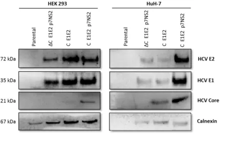 Figure  4.3.  Characterization  of  HCV-LP  produced.  Western  blot  profile  of  HCV-LP  by  Core,  E1  and  E2  expression