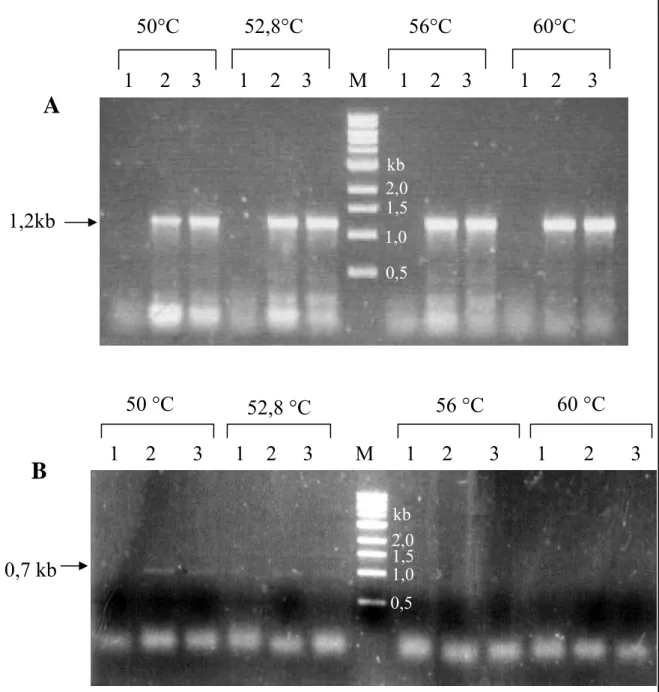 Figura 8 .  Análise eletroforética dos produtos das reações de RT-PCR. Gel de agarose  0,8% corado com brometo de etídio das (A) reações de RT-PCR com os  oligonucleotídeos E2SF/E2SR (B) e E4SF/E4SR