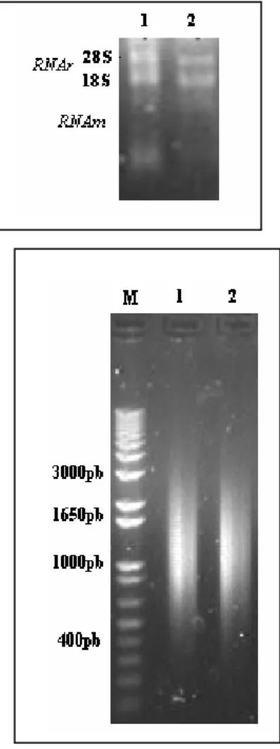 Figura 7. Fracionamento de RNAs totais das Diatomáceas T. 