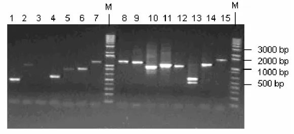 Figura 9. Fragmentos amplificados dos clones das bibliotecas de cDNA por PCR em gel de  agarose corado com brometo de etídeo