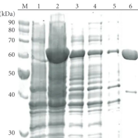 Figure 2: Recombinant enzyme purification. Fractions collected before and after Ni-NTA chromatography were visualized on 12%