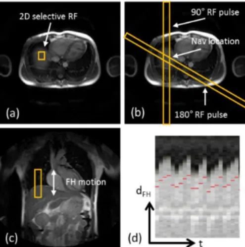 Figure 2.11: Scan planning of d1D NAV in axial plane using either a 2D selective RF