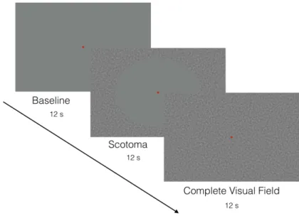 Figure 8.4: Example of the stimuli used to obtain SPZ location. Scotoma and back- back-ground stimulation using low frequency localizers scans (0 to 2 cpd).