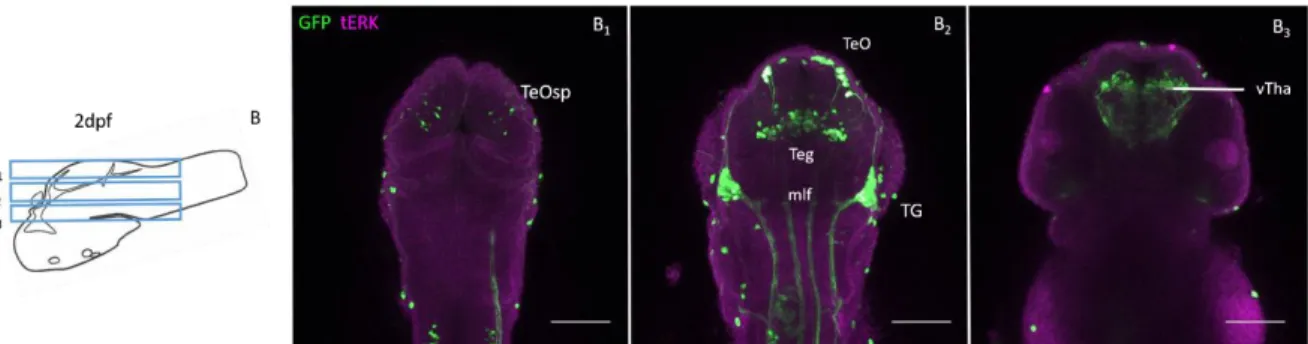 Fig. 3-2- GFP expression in 2 dpf Pitx2c: GFP zebrafish brain. B, sketch of 2dpf brain area shown in B 1-3 