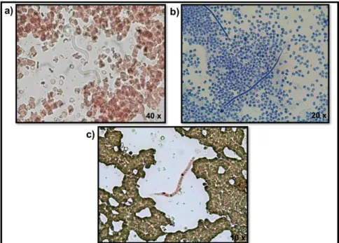 Figure 4 - Microfilariae of Dirofilaria immitis in: a) fresh blood smear; b) stained by the  Modified Knott's technique; c) stained with the acid phosphatase, highlighting the anal and 