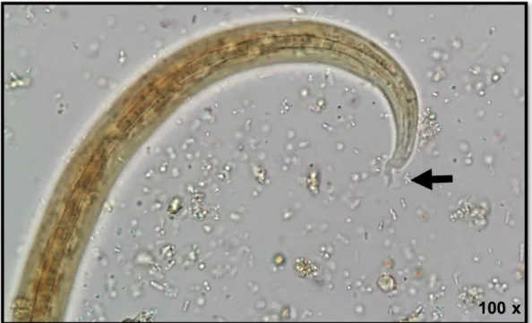 Figure 8 -  Tail of a first stage larvae of Angiostrongylus vasorum collected using Baermann  migration-sedimentation test, highlighting the characteristic sinus wave s-shaped curve with a 