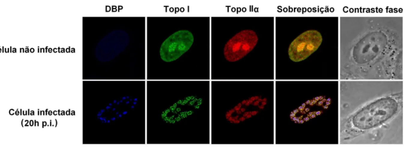 Figura 7 – Os padrões de distribuição nuclear das topoisomerases I e IIα mudam de forma  dramática em células HeLa infectadas com adenovírus