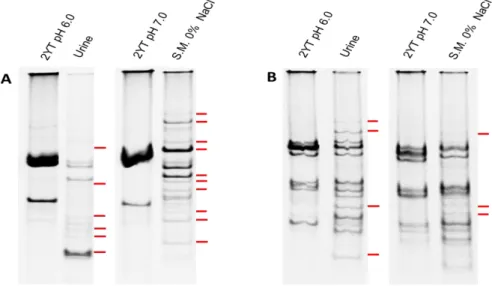 Figure 2 – RAP-PCR profiles in polyacrylamide gel using primer OPC19 and RNA extracted from LN11 (A)  and  QSE123  (B)  grown  in  urine,  skim  milk  (S.M.)  0%  NaCl  and  respective  controls