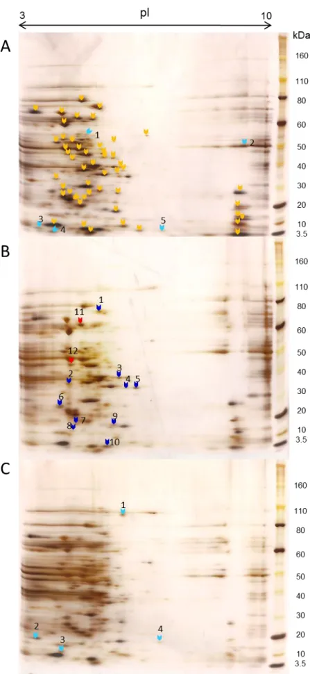 Figure 5 - Two-dimensional gel electrophoresis patterns of the whole-cell protein extracts from QSE123  (A), V583 (B) and LN11 (C) grown in urine
