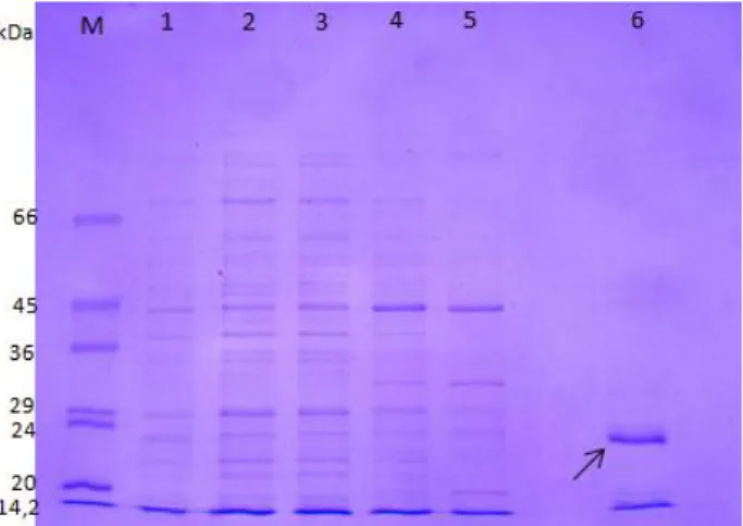 Figure II.4: SDS-PAGE analysis. Purification under  denaturing  condition  of  recombinant  BLAD  using  the  Ni-NTA  agarose  columns